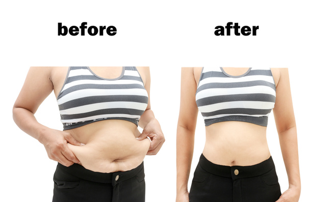  after a diet - Photo, Image