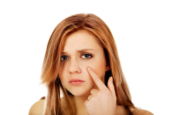 Teenage woman pointing on pimple on her cheek - Фото, изображение