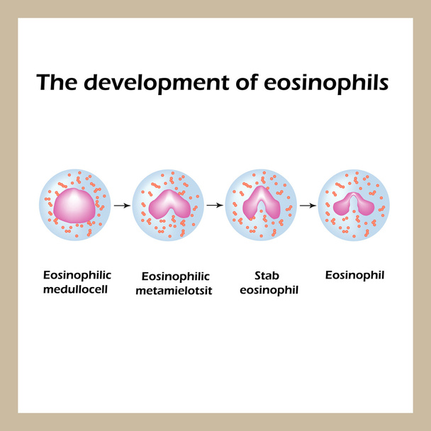 Eosinofiilien kehitys. Infografiikkaa. Vektoriesimerkki
 - Vektori, kuva