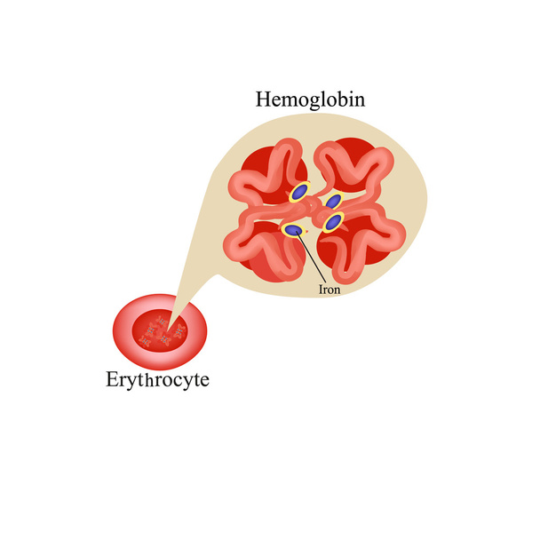 Hämoglobin innerhalb der roten Blutkörperchen. Erythrozyten. Hämoglobin. Infografiken. Vektorillustration - Vektor, Bild