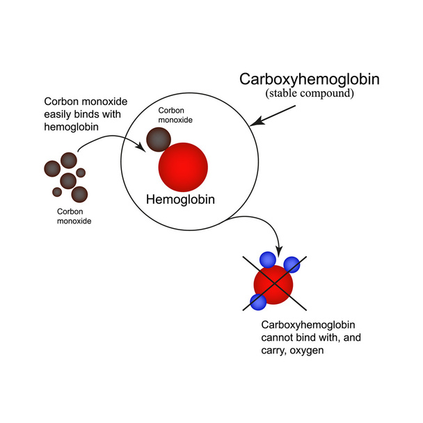 Carboxyhämoglobin. Beitritt zum Hämoglobin Kohlenmonoxid. die Unfähigkeit, Sauerstoff zu transportieren. Kohlenmonoxidvergiftung. Infografiken. Vektorillustration - Vektor, Bild