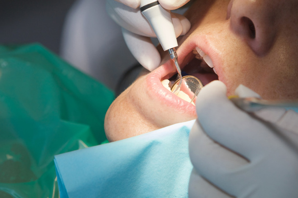 οδοντίατρος εκτελεί μια σάρωση για τον ασθενή - Φωτογραφία, εικόνα