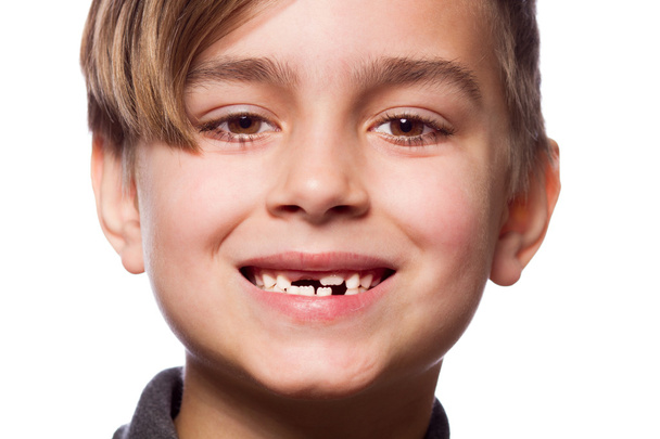 boy portrait with a lost tooth - Foto, Imagem
