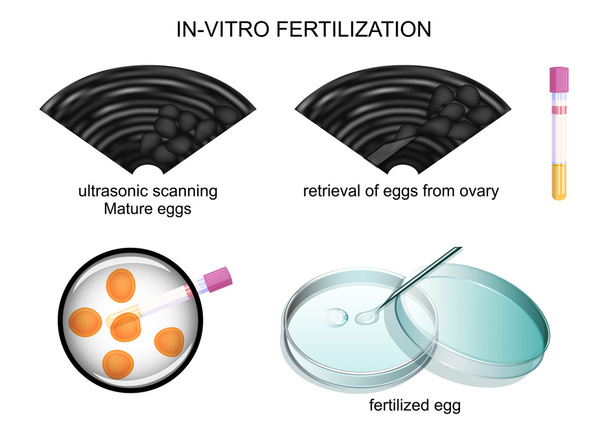 Fertilización in vitro - Vector, Imagen
