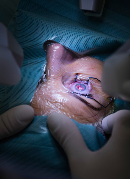 Операція на око в лікарні
 - Фото, зображення