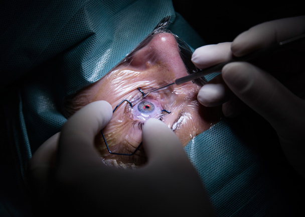 Χειρουργική επέμβαση ματιών στο νοσοκομείο - Φωτογραφία, εικόνα