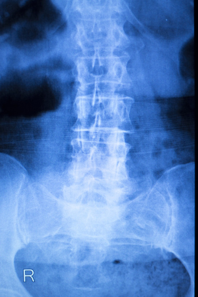 Kneck and spine injury x-ray scan - Photo, Image