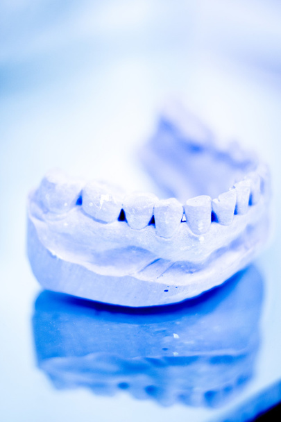 Dental prosthetics clay tooth mold - Photo, Image