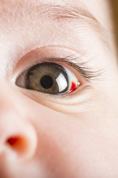 olhos vermelhos bloddshot
 - Foto, Imagem