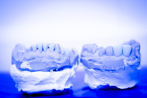 Fogászati protézis agyag fogat penész - Fotó, kép