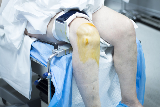 Knee arthroscopy orthopedic surgery operation - Photo, Image