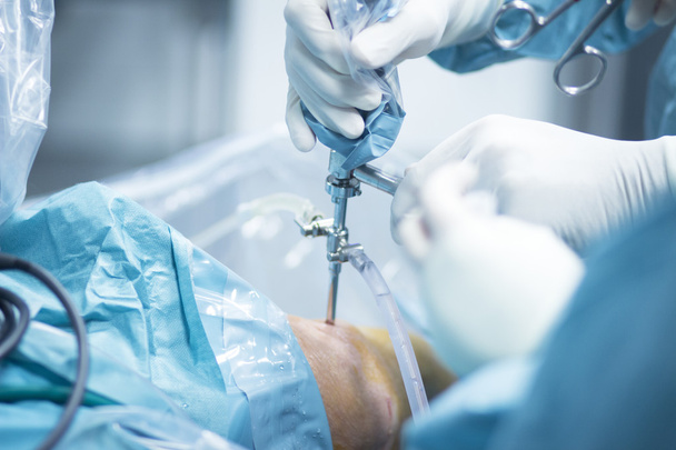 整形外科の膝の手術病院手術 - 写真・画像