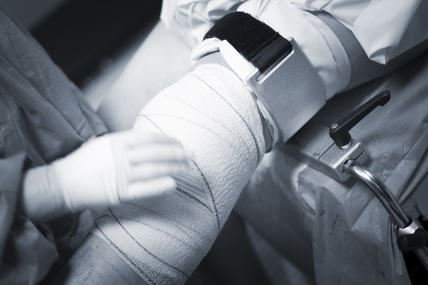 Knee arthroscopy orthopedic surgery operation - Valokuva, kuva