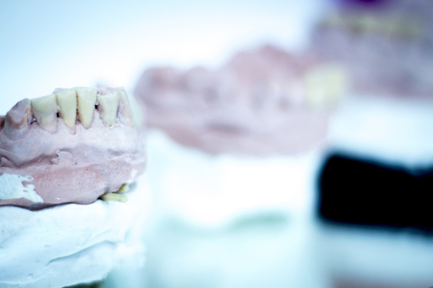 Prothèses dentaires moule à dents en argile
 - Photo, image