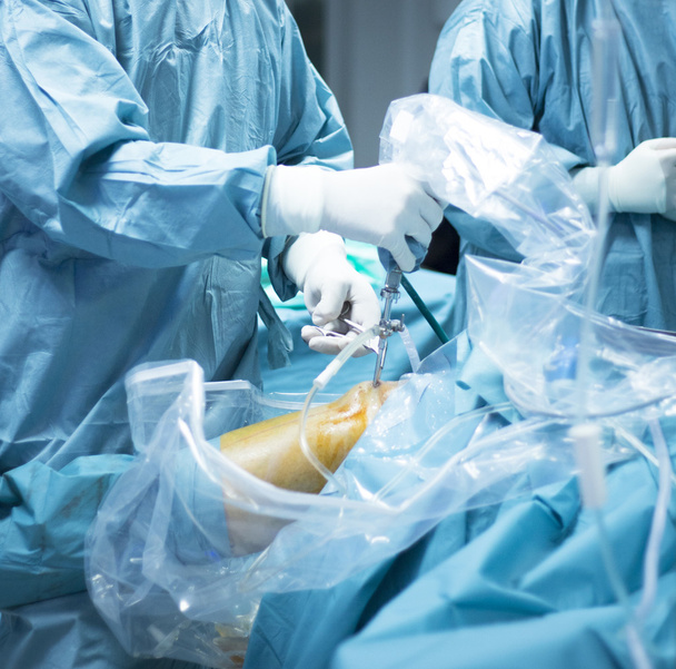 Artroskopia kolana chirurgii ortopedycznej operacji - Zdjęcie, obraz