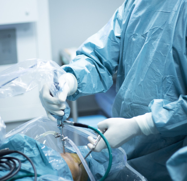 Diz artroskopisi ortopedik cerrahi operasyon - Fotoğraf, Görsel
