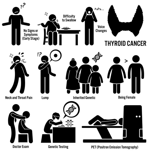 Cáncer de tiroides Síntomas Causas Factores de Riesgo Diagnóstico Stick Figura Pictograma Iconos - Vector, imagen