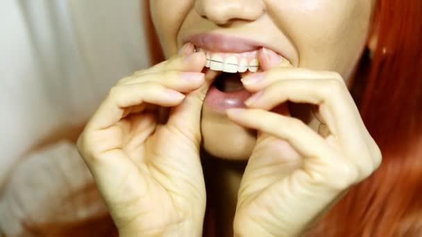 sbiancamento dei denti ragazza sorridente con vassoio dei denti Bella ragazza sorridente con vassoio dei denti (mani che tengono vassoio dei denti individuale
) - Filmati, video