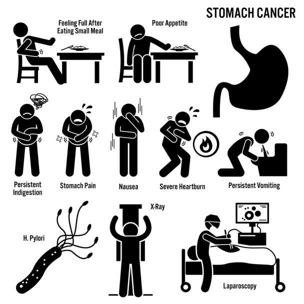 Cáncer de Estómago Síntomas Causas Factores de Riesgo Diagnóstico Stick Figura Pictograma Iconos - Vector, Imagen