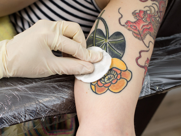 Preparación de la mano para la corrección del tatuaje
 - Foto, imagen