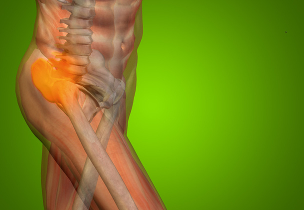 joint or articular pain, ache - Photo, Image