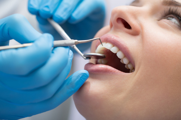Dentist examining a patients teeth in the dentist. - 写真・画像