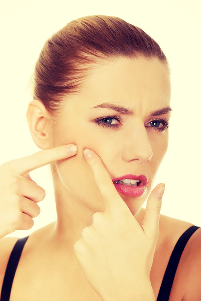 Woman squeezing a pimple. - Foto, Imagem