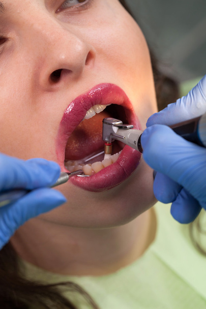  Young girl having dental check up - Photo, image