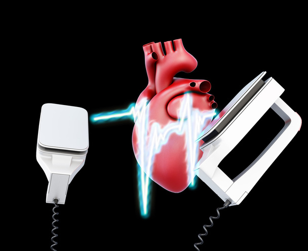 Defibrillatore e cuore su sfondo nero
. - Foto, immagini