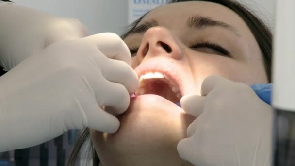 Healthcare teeth problem woman at dentist - Πλάνα, βίντεο