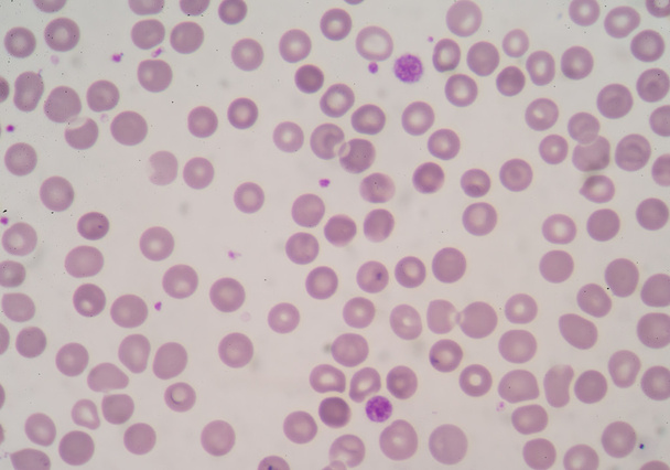  血小板と白血球の顕微鏡  - 写真・画像