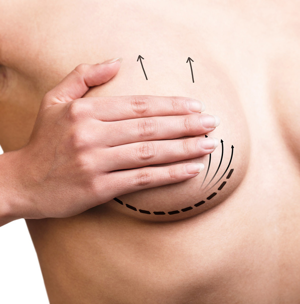Breast  correction. Plastic surgery - Фото, зображення