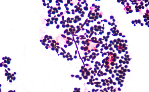 Oksastava orastava hiiva solujen pseudohyfae virtsassa gram st
 - Valokuva, kuva