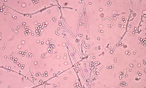 Ramificación de las células de levadura en ciernes con pseudohifas en la orina w fina
 - Foto, imagen