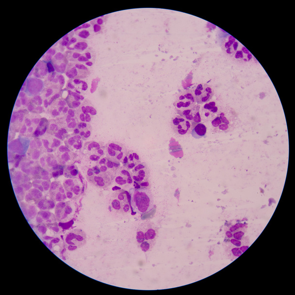 Tulehdusreaktioon liittyvät kemialliset ja solutekijät
 - Valokuva, kuva