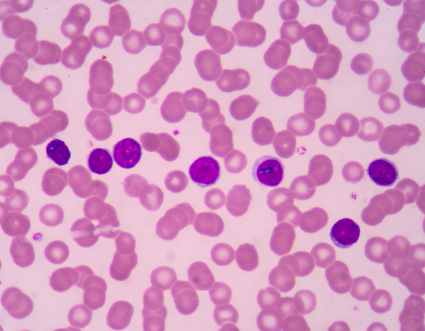 Lymphocyte. Immune cell. Antibody-producing cell. B-lymphocyte o - Photo, Image