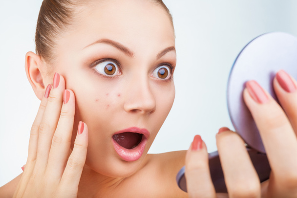 acne em mulheres
 - Foto, Imagem