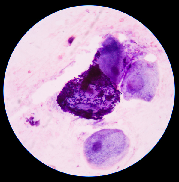 Células azules bacterianas
 - Foto, imagen