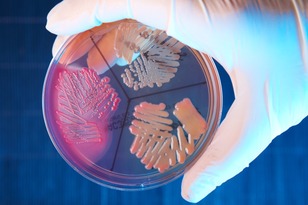 bakterie patologiczne - Zdjęcie, obraz