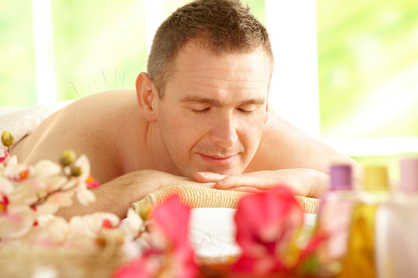 muž dostává akupunkturní léčby v lázních - Fotografie, Obrázek