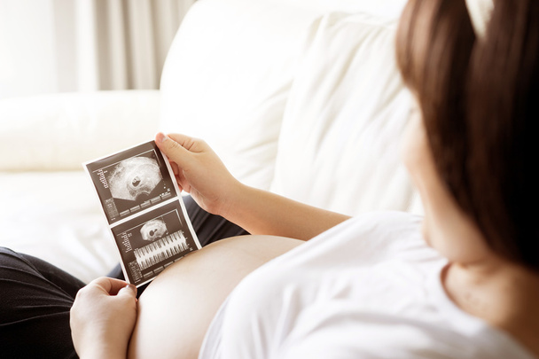 Pregnant woman with ultrasound scan picture  - 写真・画像