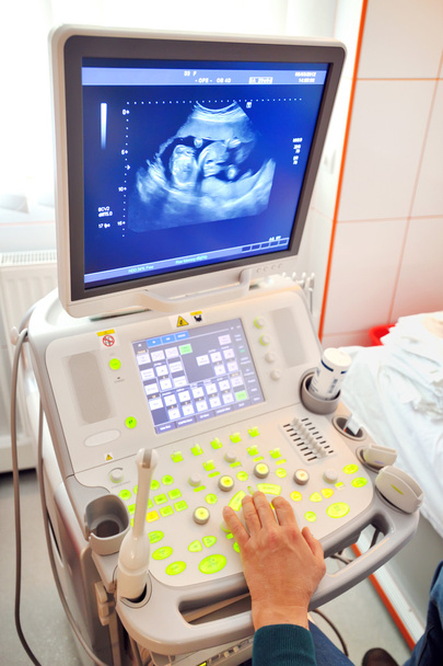 ιατρική εξέταση έγκυος - Φωτογραφία, εικόνα
