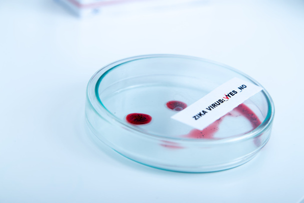 Blood sample positive with Zika virus - Photo, Image