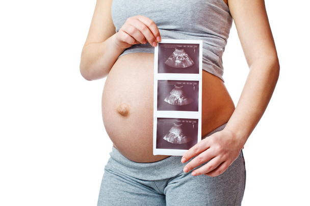 Pregnant woman with ultrasound image - Foto, imagen