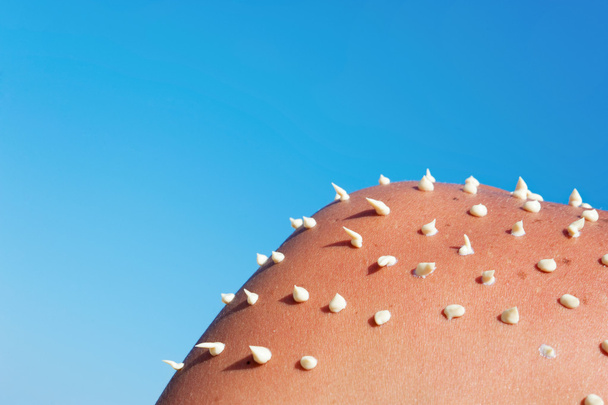 Crème solaire en forme d'aiguille sur l'épaule bronzée des hommes
. - Photo, image