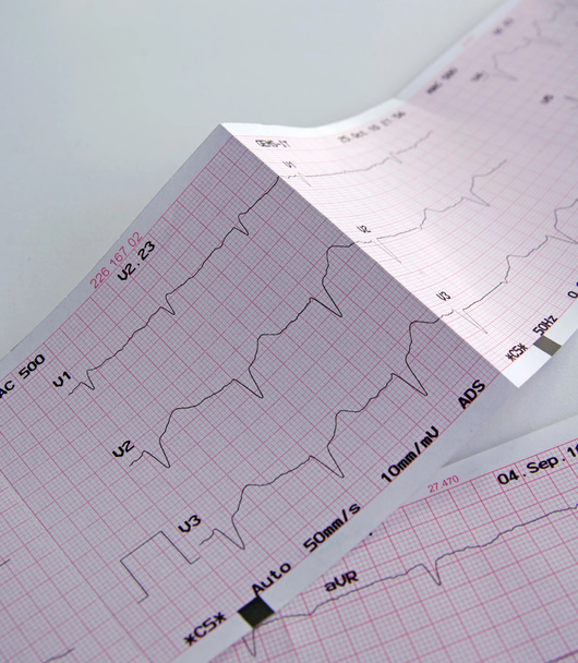 Cardiogramma, grafico ECG
 - Foto, immagini