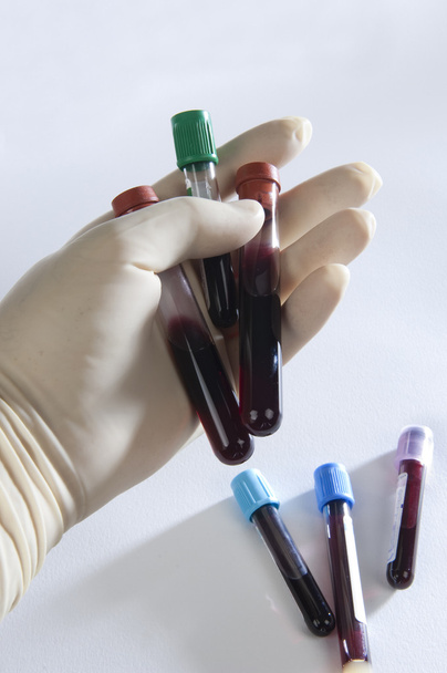 Tubes, and blood samples - Fotoğraf, Görsel