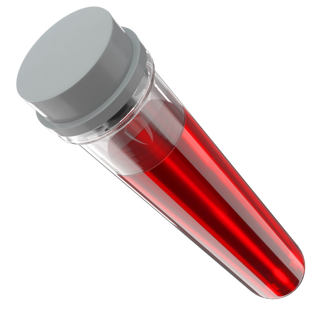 amostra de sangue num tubo de ensaio
 - Foto, Imagem