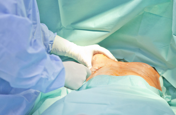 e mellnagyobbító műtét a műtőben sebész eszközök implantátum - Fotó, kép