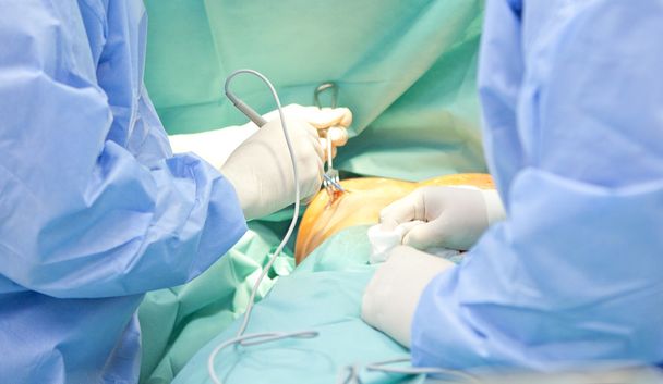 chirurgie d'augmentation mammaire dans la salle d'opération outils chirurgien implant
 - Photo, image